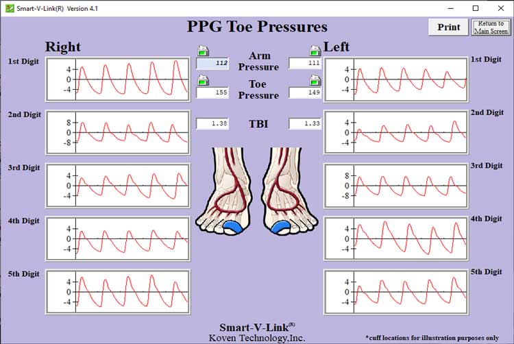 PPG Toe Pressures Screen