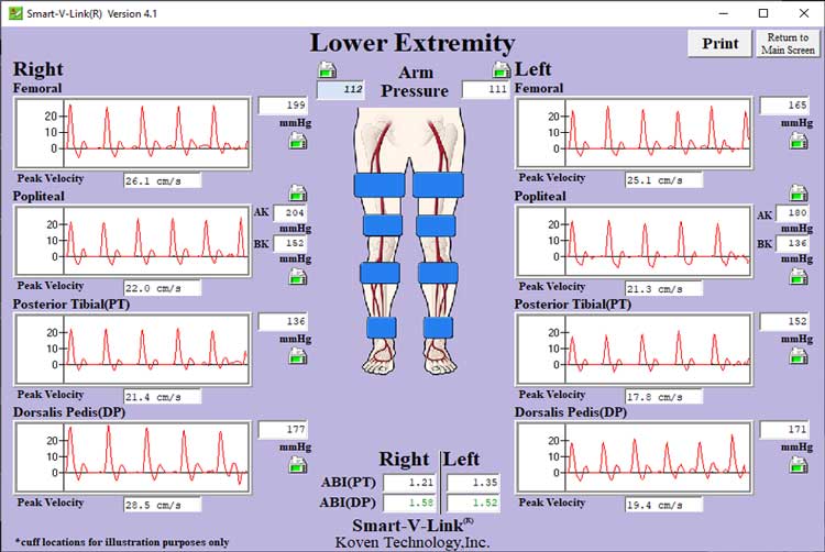Segmental Pressures Screen