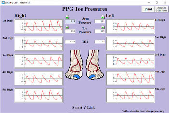 PPG Toe Pressures