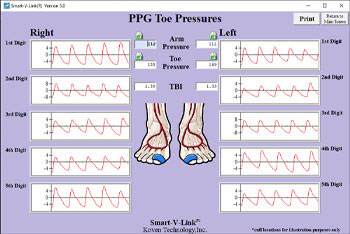 PPG Toe Pressures