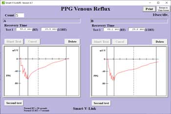 Venous Reflux Test Screen