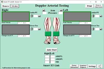 Ankle Brachial Index Screen