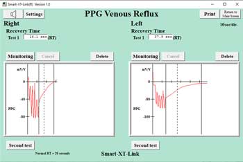 Smart-XT-Link6 Venous Reflux Test Screen